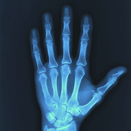 hand